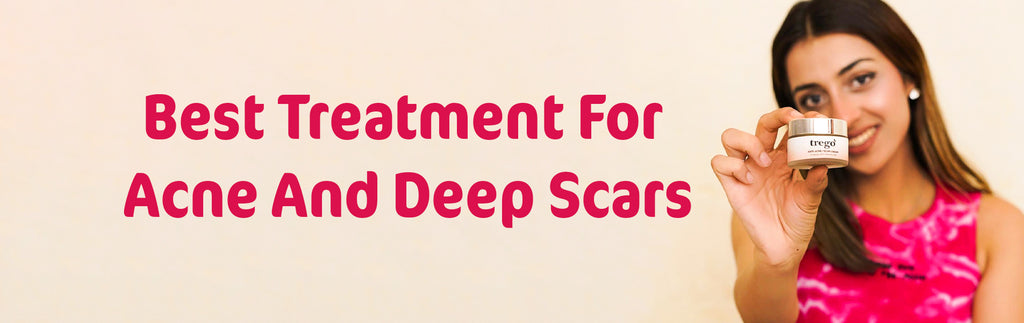 Revolutionary Elixir: Unveiling the Best Acne Cream in Pakistan